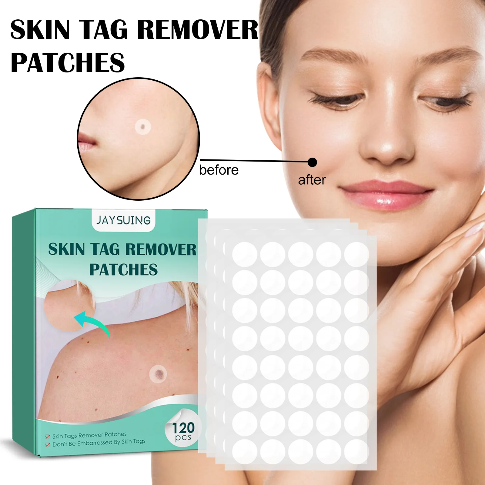 

120 pcs/box Skin Tag Remover Patches Mole Warts Removal Sticker Tags Dries And Fall Away Natural Ingredients Skin Care Tool