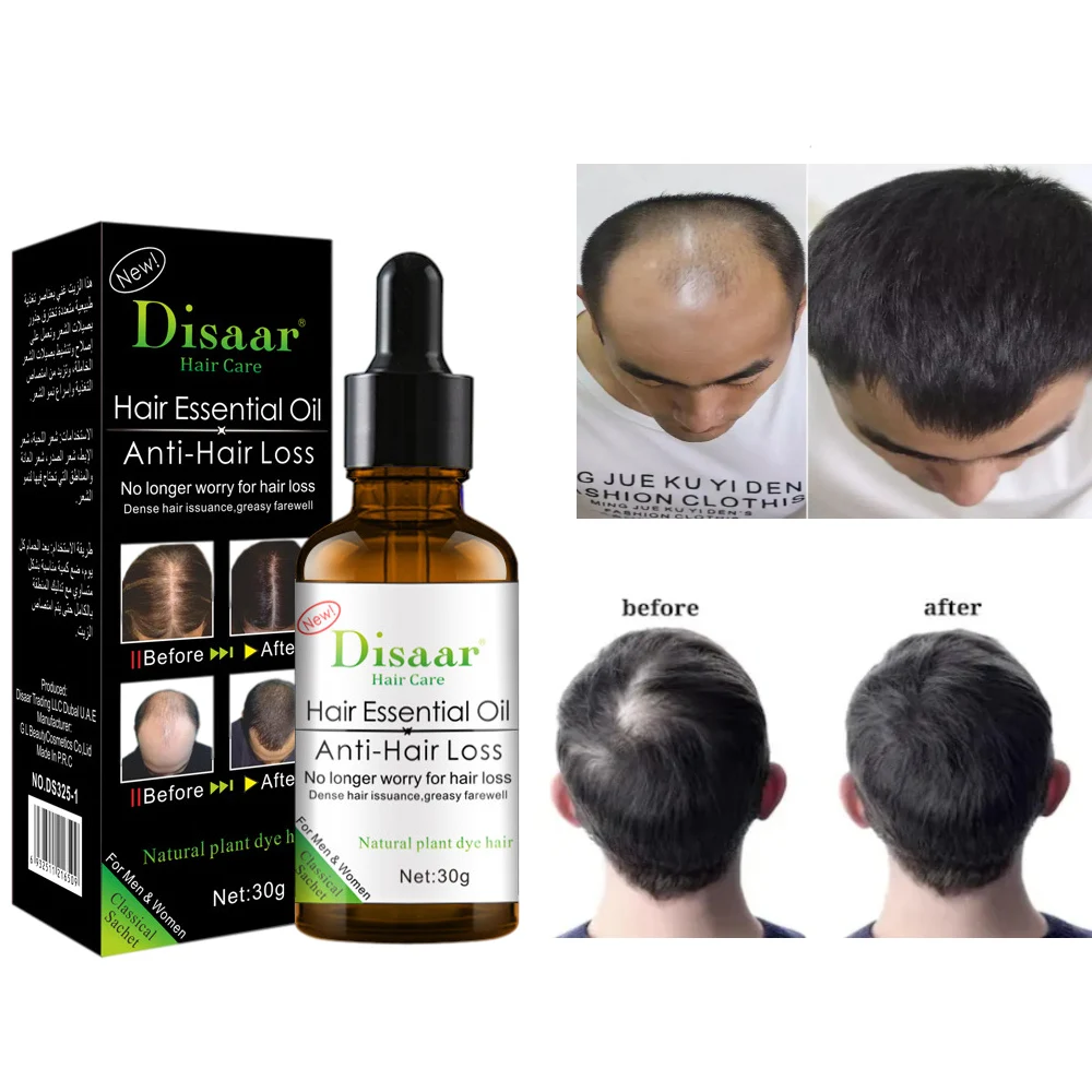 

35 Days Hairs Regrowth Anti-Hair Loss Oil Repairs Follicles Thicker Nature Strong Thinning Treatment Hairline Growth Liquid