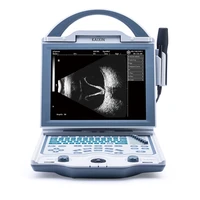 kaixin odu5 full digital ophthalmic ab ultrasound scanner