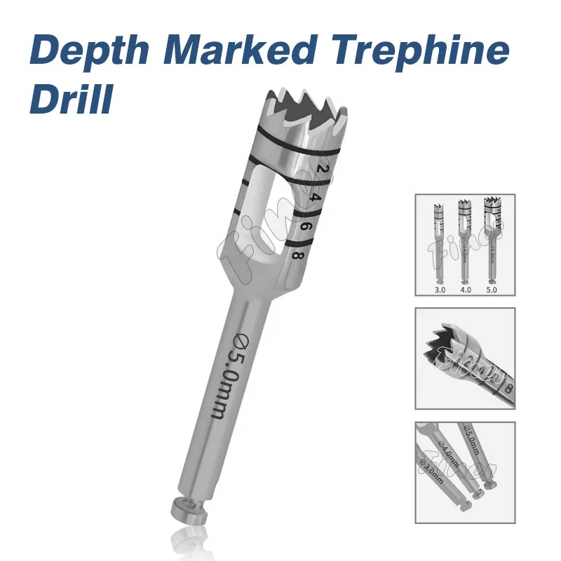 резак для мягких тканей с маркировкой глубины сверло трепаном окружная резка