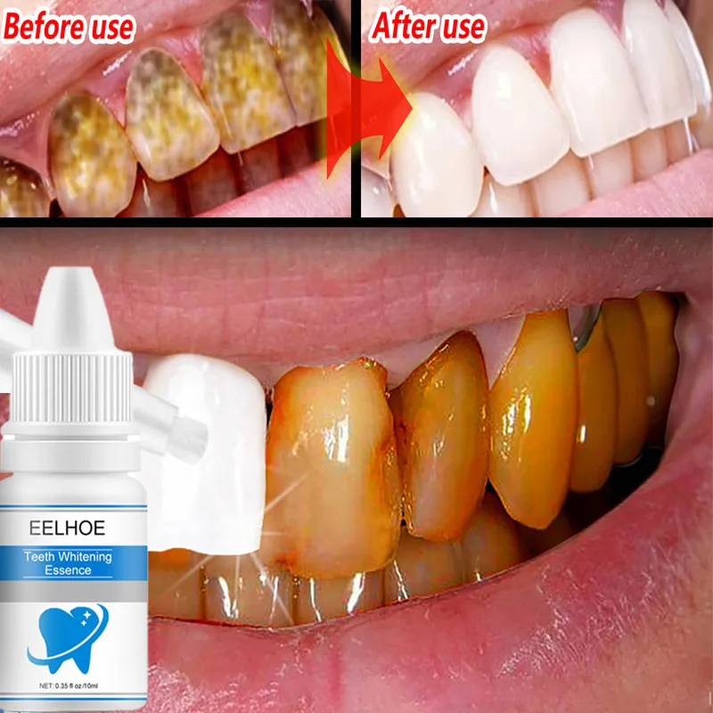 Teeth Whitening Essence Tooth Gel Whitener Bleach Remove Stains Dentistry Whiten toolsTeeth Cleaning Kit Fresh Breath Oral Care
