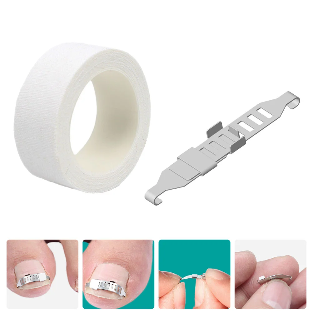 

1 Set Orthodontic Nail Tools Curved Corrector Nail Correction Accessory
