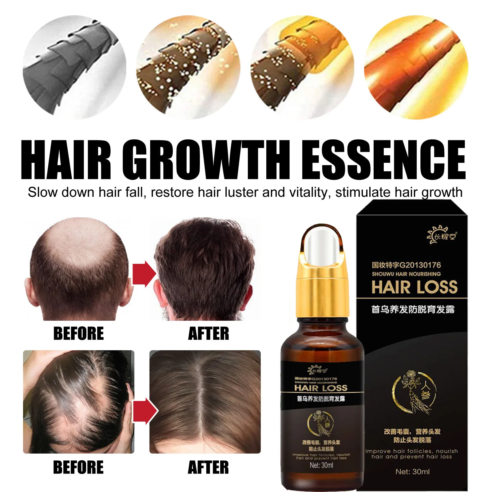 Hair Growth Products Fast Growing Oil Loss Care Liquid Beauty &amp Scalp Treatment Dense Serum |