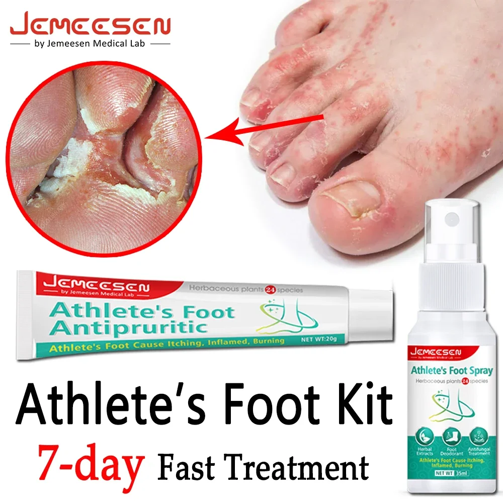 

Jemeesen Athlete's Foot Treatment Kit Beriberi Anti-Itch Spray Toe Lnfection Peeling Itching Cream Foot Deodorant Antifungal Kit