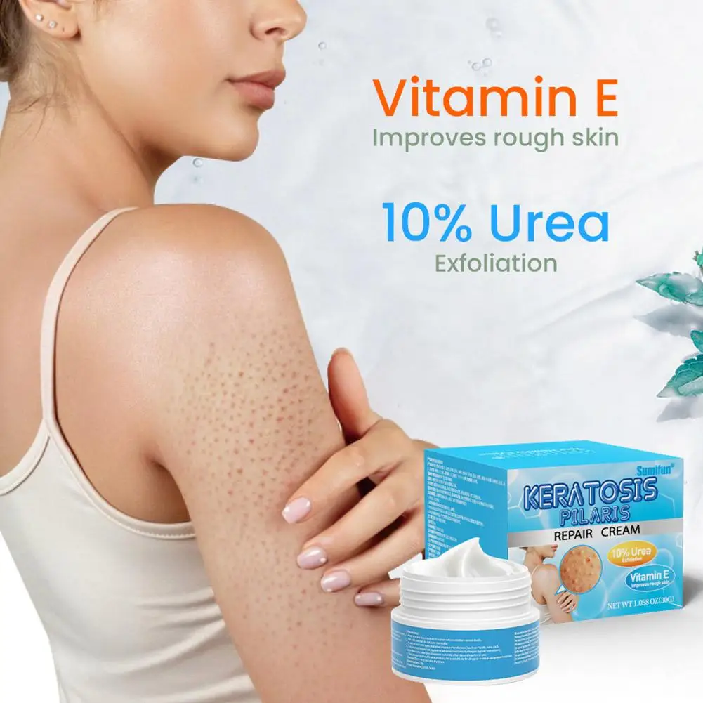 

Vitamin E Keratosis Pilaris Repair Treatment Cream Acne Skin Deep Brighten Remove Moisturizing Chicken Smooth Skin Spots Ca D2J7