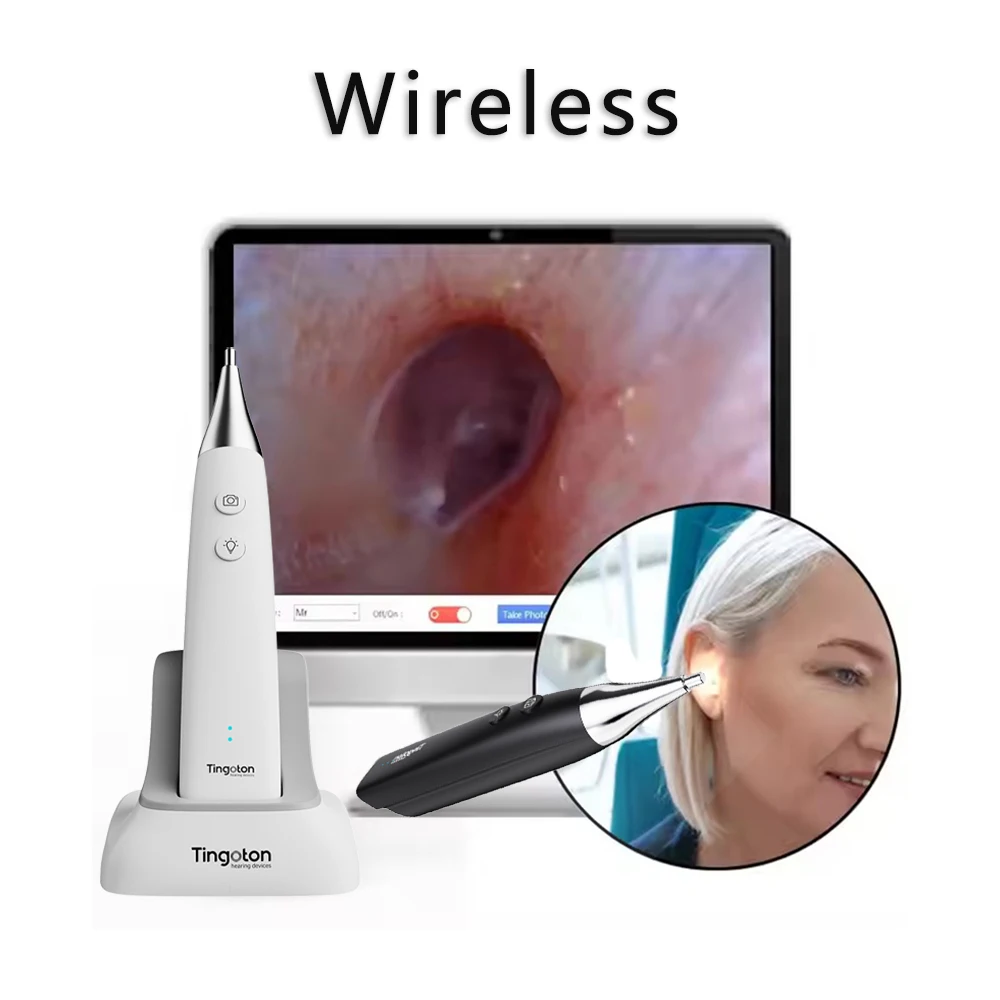 Видео беспроводной UHD отоскоп ушная камера захват цифрового изображения уход за