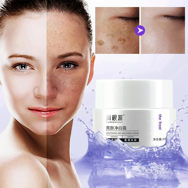 

Rungenyuan Lightening and Whitening Cream 35g pigmentation removal cream Face care skin whitening cream Nourish Smooth Cosmetics