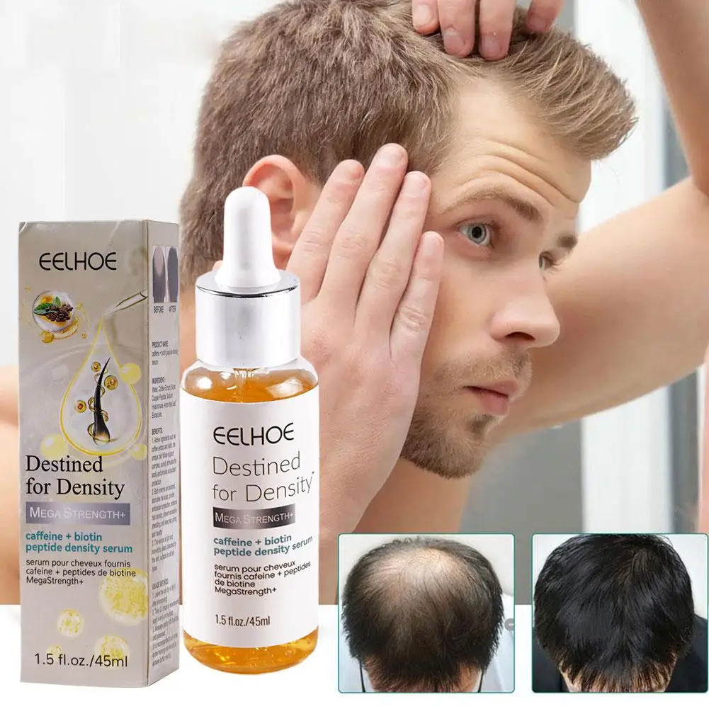 

Hair Follicle Treatment Essence Fast Serum Baldness Postpartum Alopecia Hair Upward Loss Hairline Seborrheic X9T3
