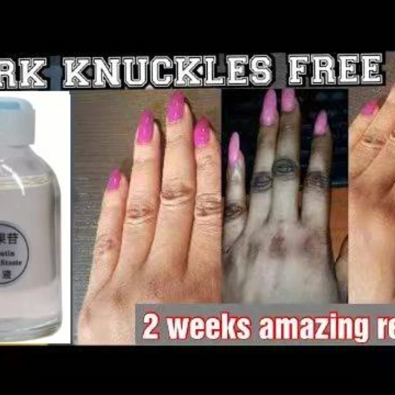 

Dark Knuckles Corrector Gel Serum Arbutin Super EFFECTIVE for Dark Spots Dark Knuckles REPAIR firming skin tightening cream