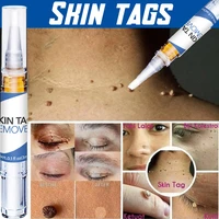 removing against moles liquid pen treatment papillomas removal of warts liquid from skin tags remover anti verruca remedy