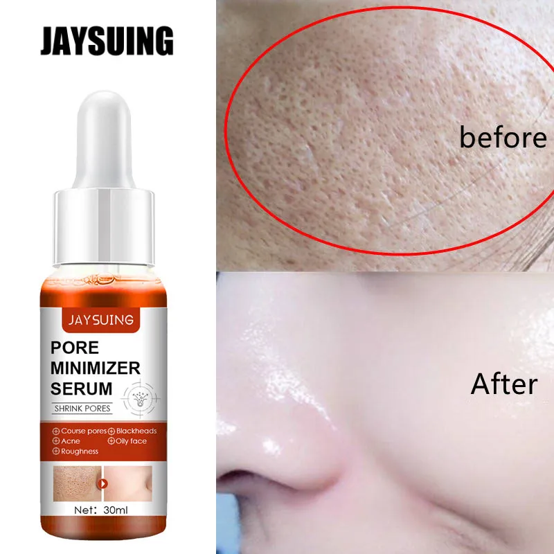 

Salicylic Acid Shrink Pores Facial Serum Firm Moisturizing Essence Liquid Repair Face Pores Beauty Skin Care Korean Cosmetics