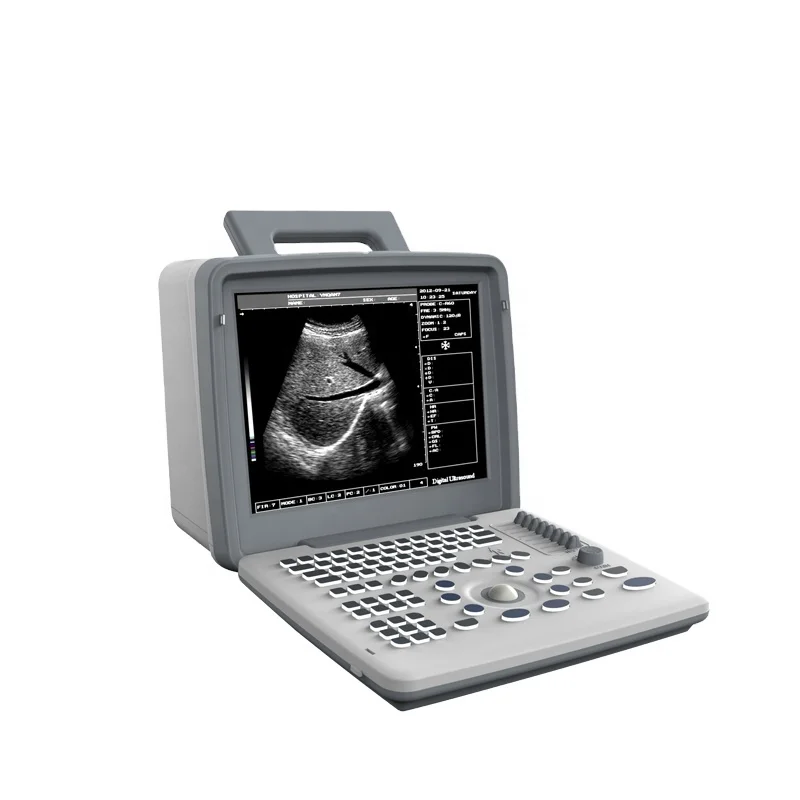 

Hot Selling Clinic Use Cheapest Ultrasound Scan Machine Portable for Sale