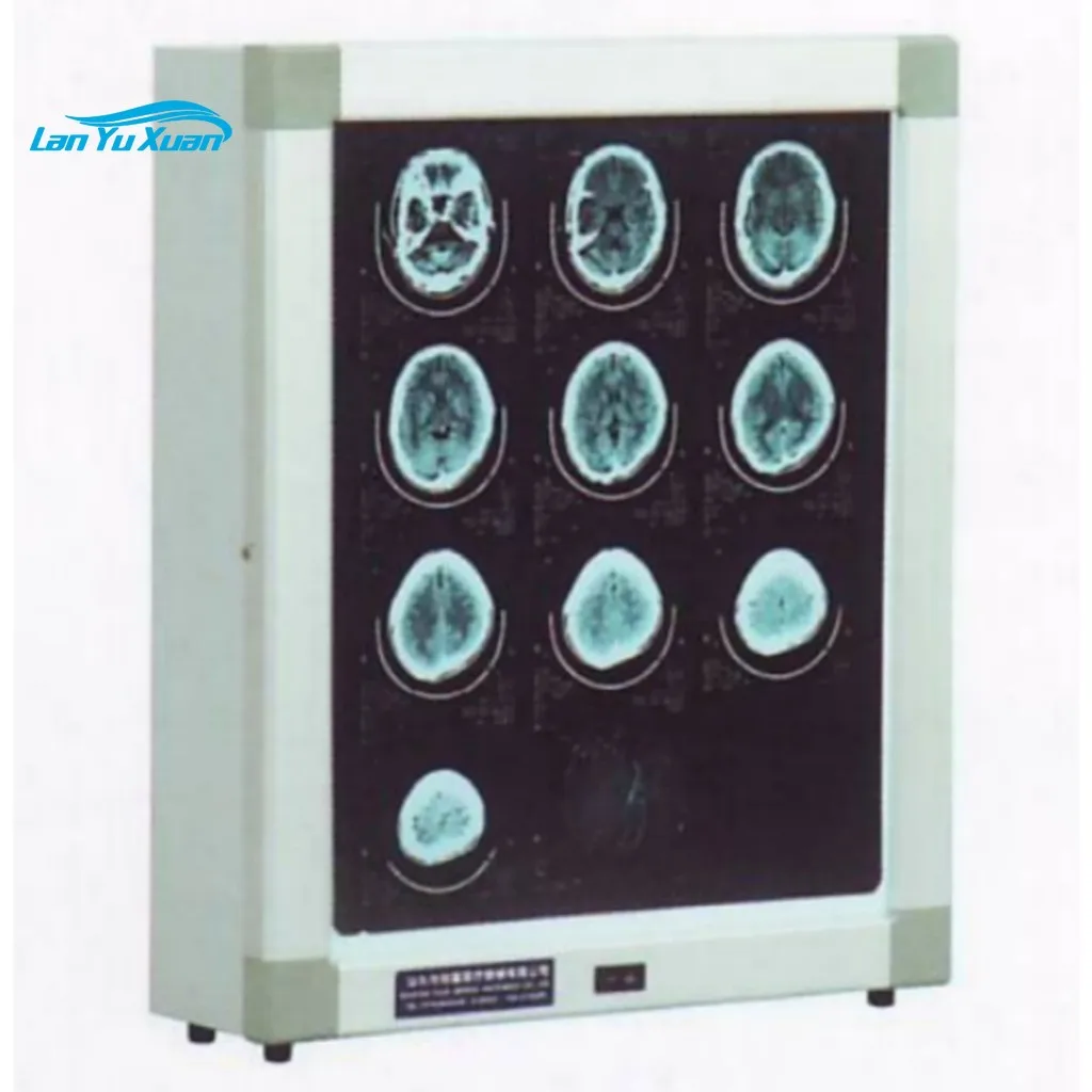 

2019 latest medical XD Series X-ray Film Illuminator LED high brightness hospital room use quality x ray film viewer