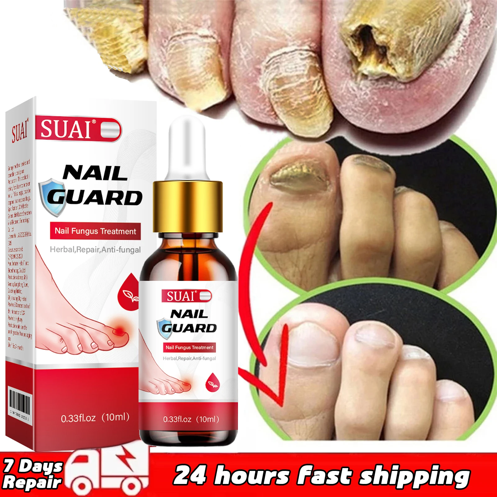

100% Original Fungal Nail Treatment 7DAYS Repair Feet Care Essence Anti Infection Onychomycosis Foot ToeNail Fungal Removal Gel