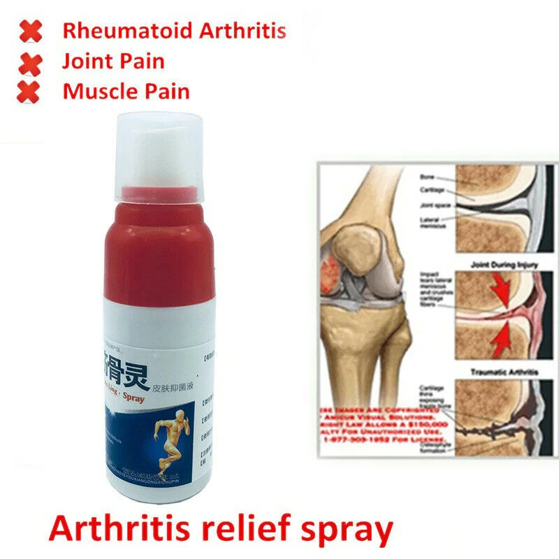 

Sdotter 30ml Pain Relief Spray Rheumatism Arthritis Muscle Bone Portable For Sprain Knee Waist Rrheumatoid Arthritis Leg Massage