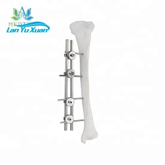 

orthopedic external fixation external fixator Femur and Tibial External Fixator