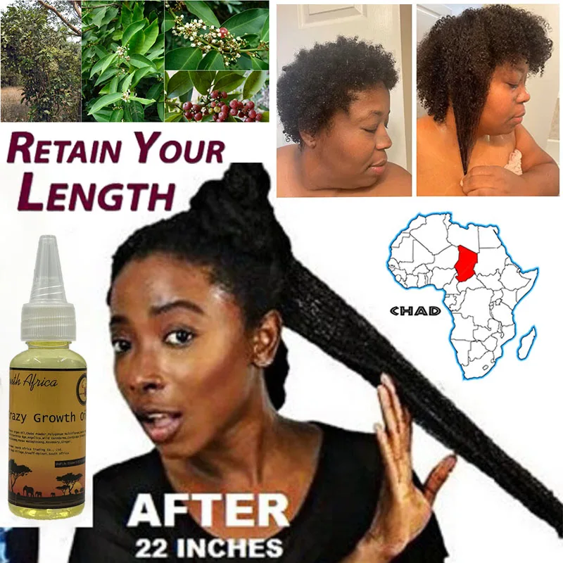 

Fast Hair Growth Oils The Secret To Get Thicker Longer and Healthier Hair Ayurvedic Herbs Rapid Hair Growth Stop Alopecia Remedy