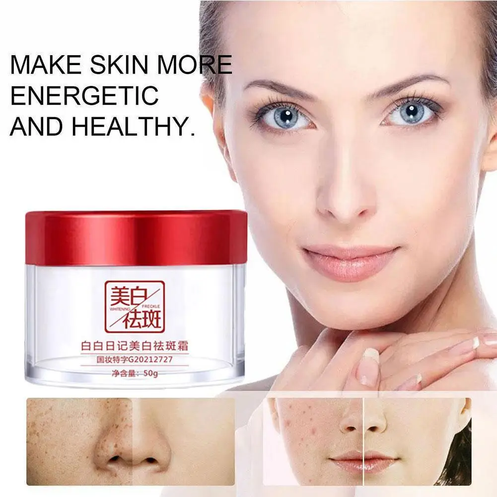 

Whitening Freckle Cream Remove Dark Spots Melasma Lighten Anti-aging Face Acne Scar Skin Brighten New Care 2023 W6S7