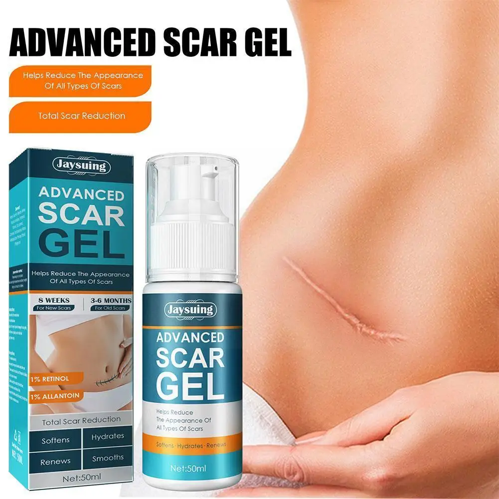 

Acne Scar Removal Cream Pimples Stretch Marks Face Pigmentation Skin Whitening Gel Care Remove Smoothing Corrector Acne Bod S6y7
