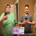 Мощный жиросжигатель для похудения, Детокс, жиросжигатель, продукты для снижения веса, диетические таблетки, тонкие Пластыри для похудения, для похудения, для красоты живота