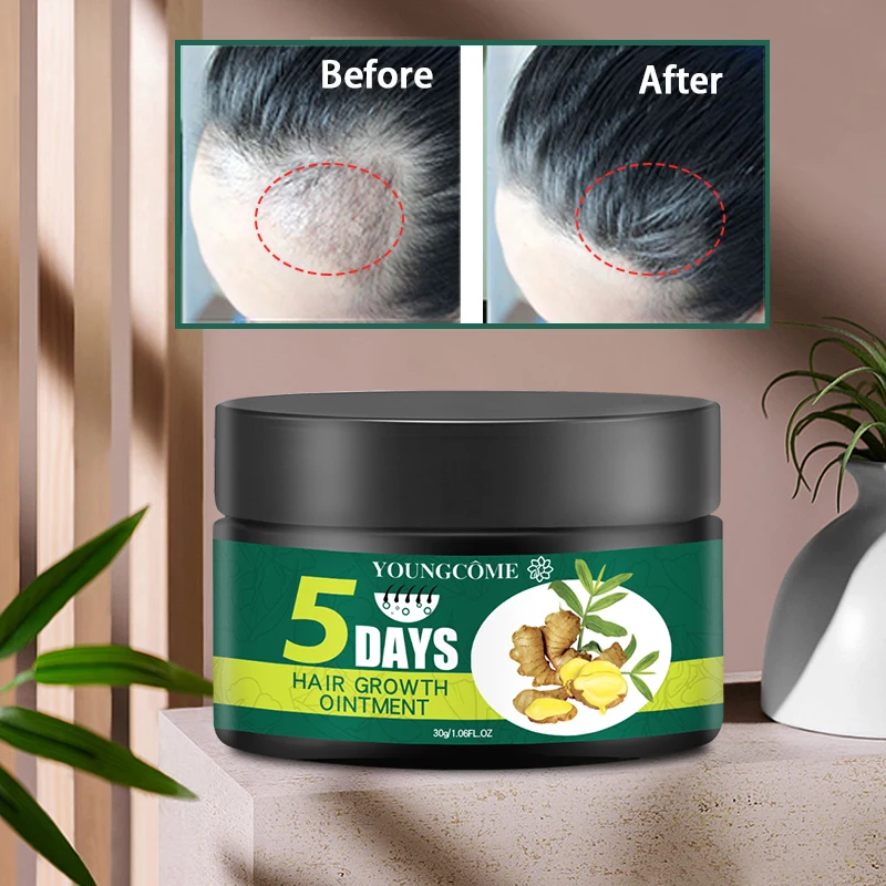 YOUNGCOME 60g 5 Days Hair Growth Ointment Promote Blood Circulation Protect Loss Control Oil Products |