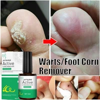 warts foot corn remover skin tag mole removal genital wart acne spot treatment liquid foot calluses callosity detox skin care