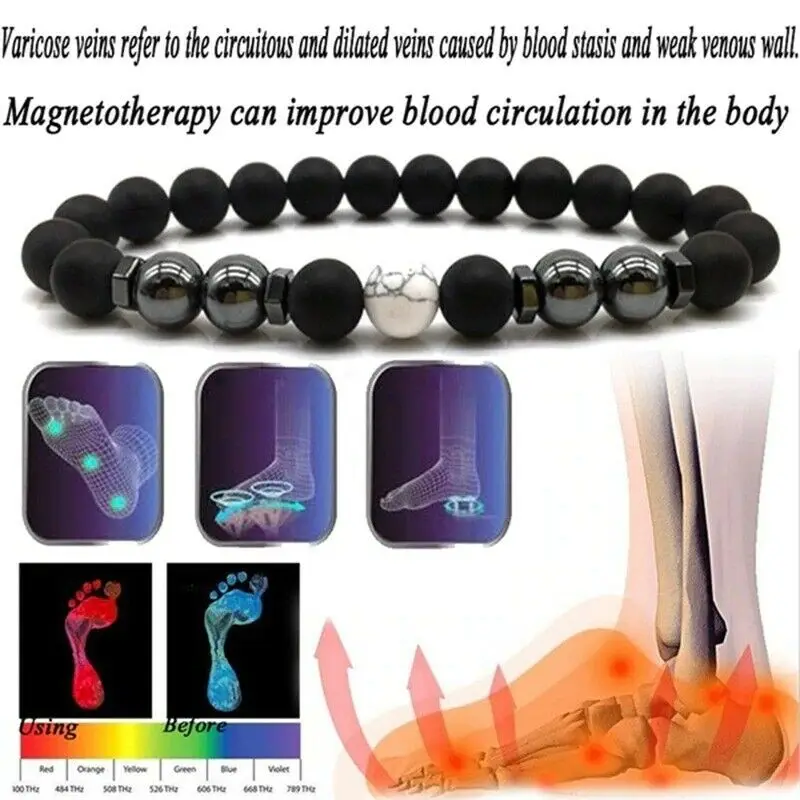 Treatment of Varicose Veins Obsidian Anklet Adjustable Weight Loss Magnetic Therapy Magnet Bracelet for Mom Dad | Украшения и