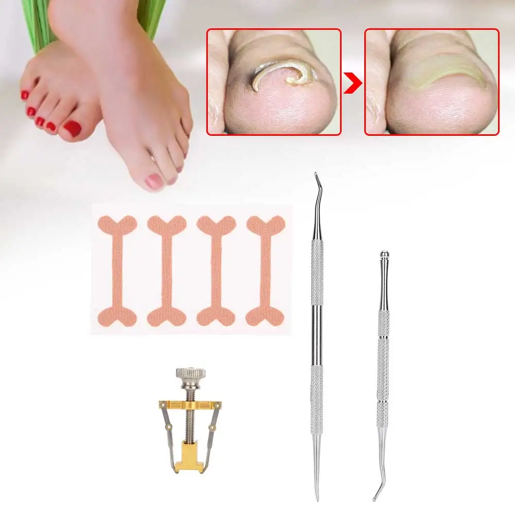 

Stainless Steel Ingrown Toenail Corrector Toenail Picker File Toe Sticker Correction Tool Set Professional Foot Nail Care Tools