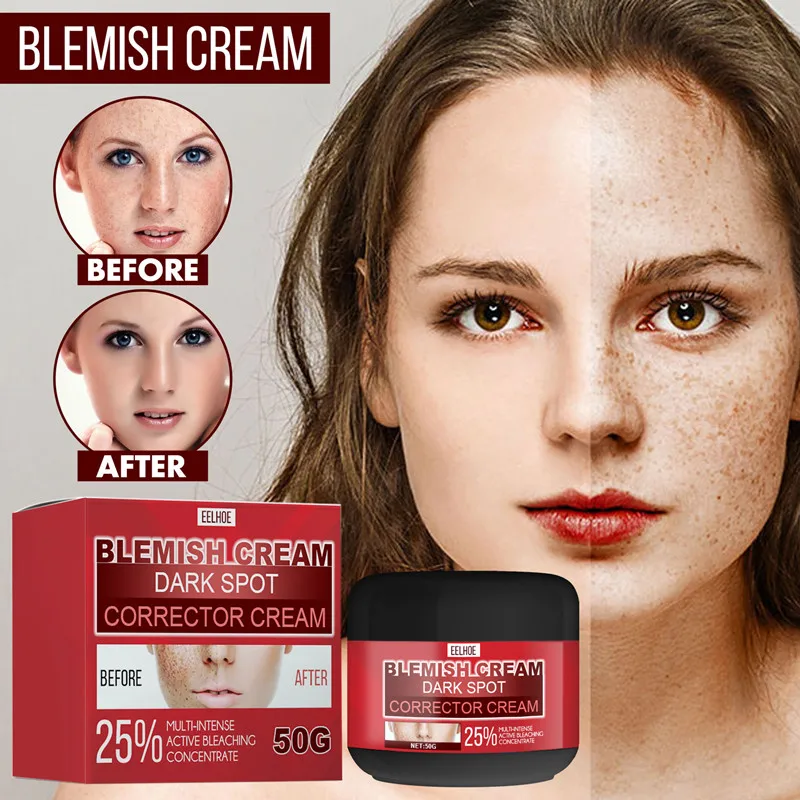

50g Whitening Freckle Cream Remove Melasma Acne Spot Pigment Melanin Dark Spots Pigmentation Moisturizing Gel Skin Care