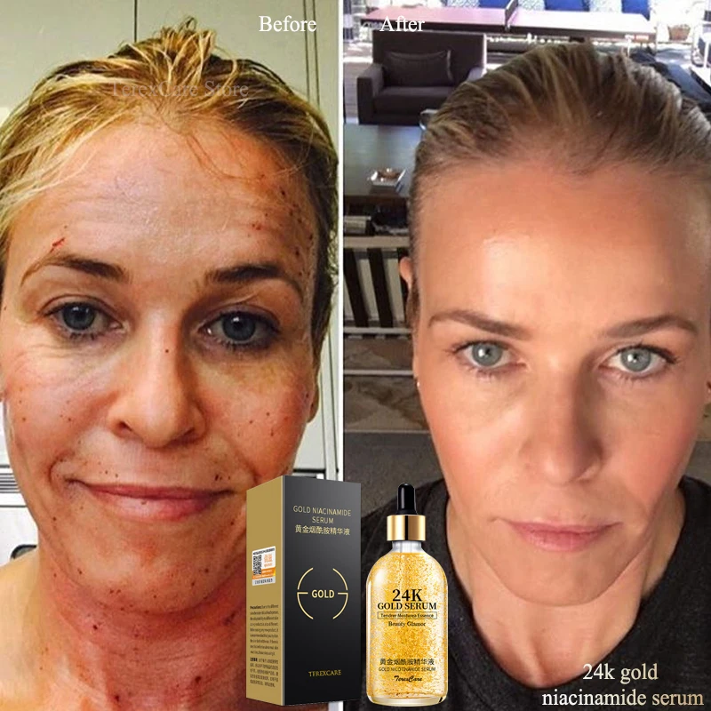 Оригинальный раствор никотинамид 24k Gold