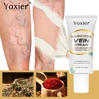 varicose vein cream promote blood circulation spider veins phlebitis treatment nourish ease legs painful swelling body care 50g