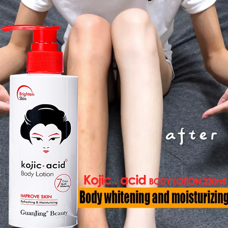 

Kojic acid Whitening Skin Lightening Body Lotion Bleaching Cream Retinol A & Vitamin E Dark Spot Treatment for Women 230ml
