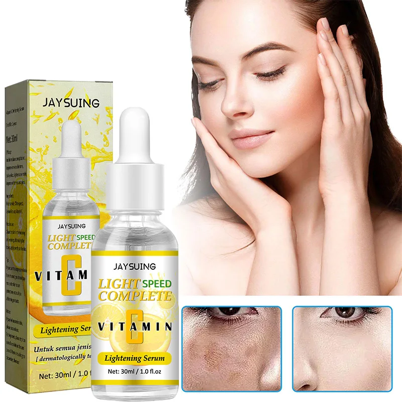 

Niacinamide ночной крем для веснушек отбеливающий увлажняющий Осветляющий антивозрастной продукт для ухода за кожей лица омолаживающий крем 20 г