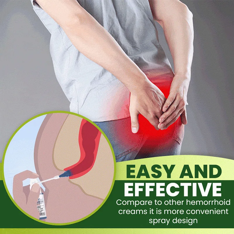 Натуральный травяной геморрой спрей 30 мл облегчение боли без стимуляции лечения