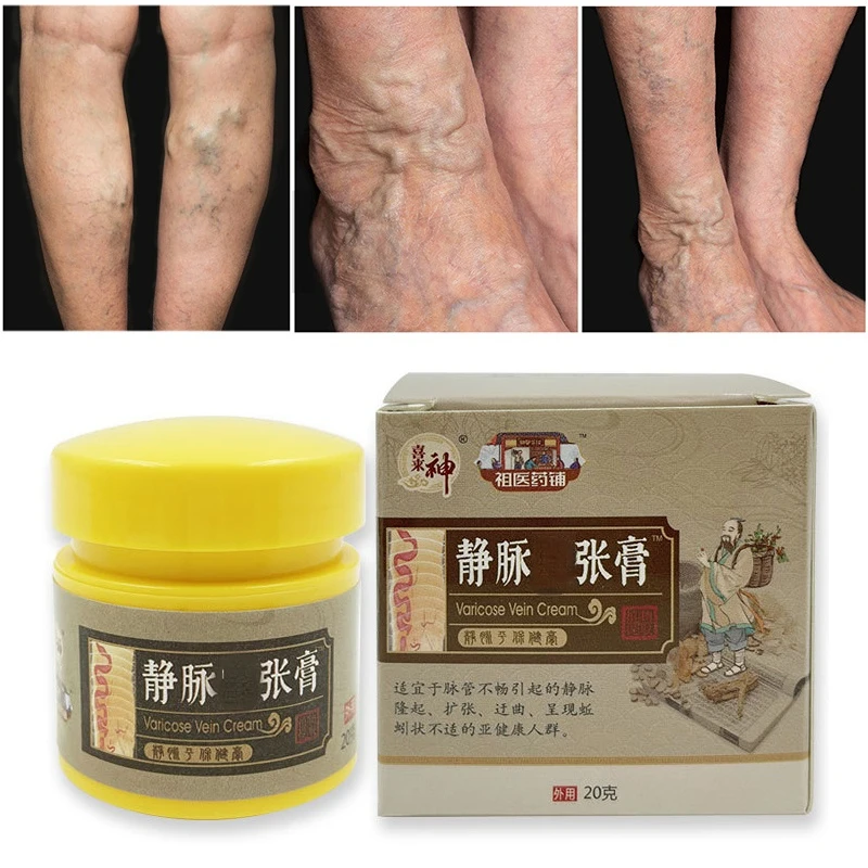 

20g Varicose Vein Repair Cream Massage Soothes Puffiness Vasculitis Itching Mineral Vegetable Oil Body Private Part Skin Care