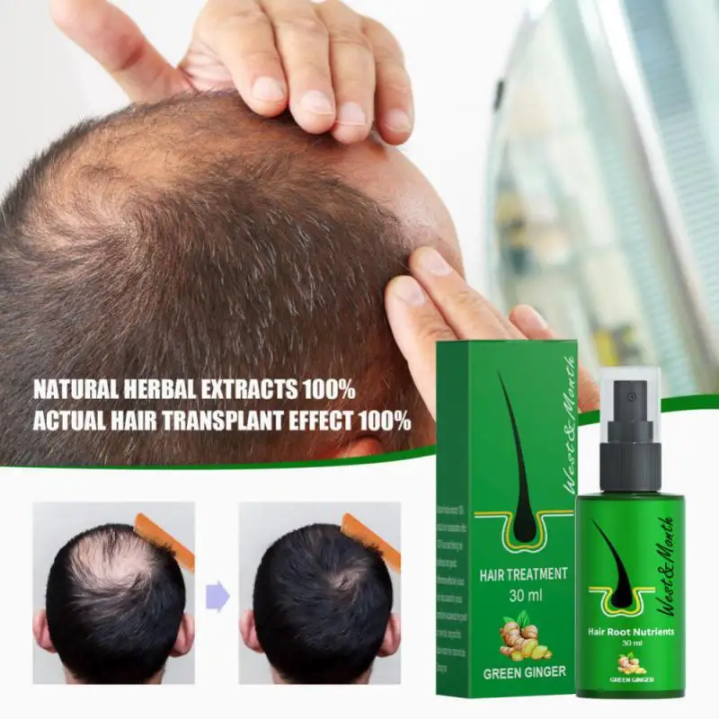 

Hair rebirth Herbal Spray Regrowth Nourishing Ginger Oil Serum Promote Quickly Grow Thick Hair Growth Products For Man Women