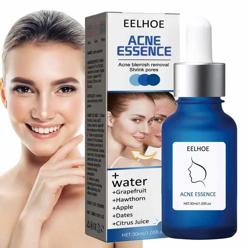 

Pore Shrinking Essence Skin Pimple Repair Moisturizer For Face 30ml Face Essence Hydrating Serums For Pimples Blackheads