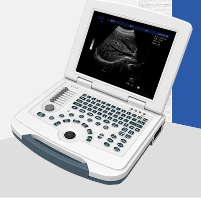 Высококачественный ультразвуковой производитель эхолографии портативный