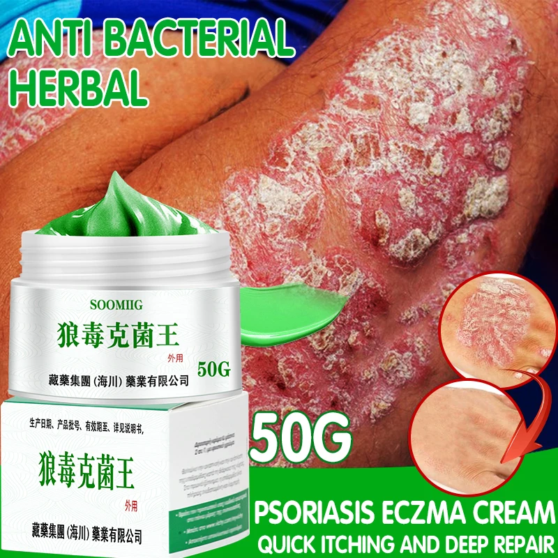 

Against Psoriasis Cream Natural Herbal Ointment Antibacterial Gel Anti-Itch Eczematoid Urticaria Psoriasis Skin Treatment 50g