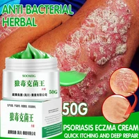 against psoriasis cream natural herbal ointment antibacterial gel anti itch eczematoid urticaria psoriasis skin treatment 50g