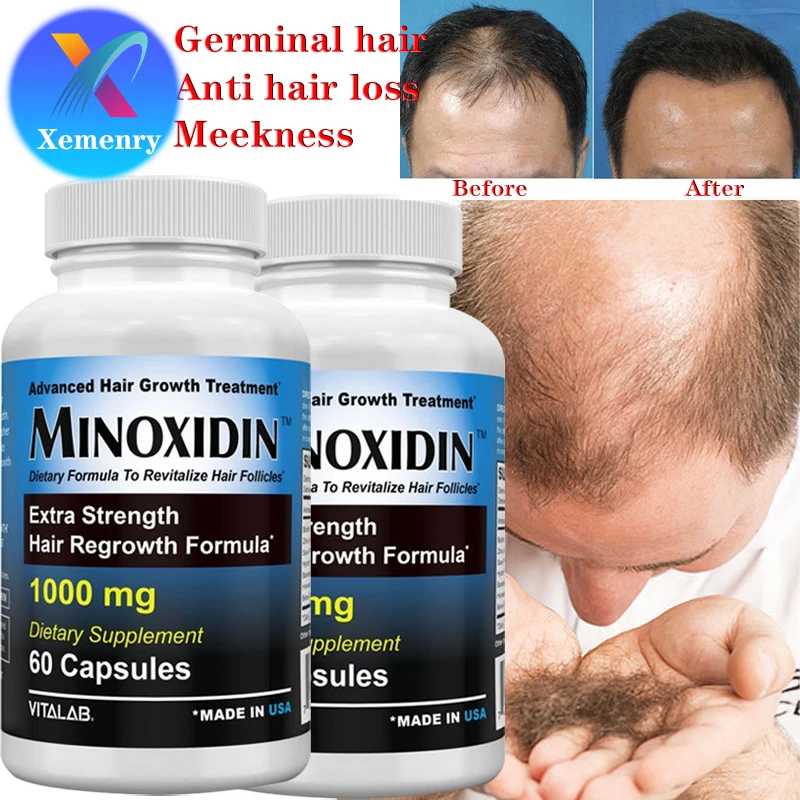 

Xemenry Hair Growth Supplement 5,000 Mcg Capsules with Biotin - Hair Skin and Nails Vitamins - Hydrolyzed Collagen Biotin Pills