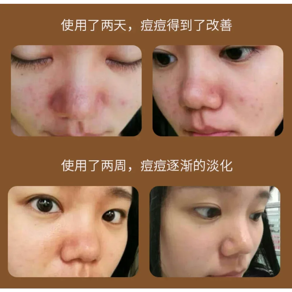 Oligopeptide-1 Сыворотка для лица 15 мл Высокочистый компонент Плацента Реставрация