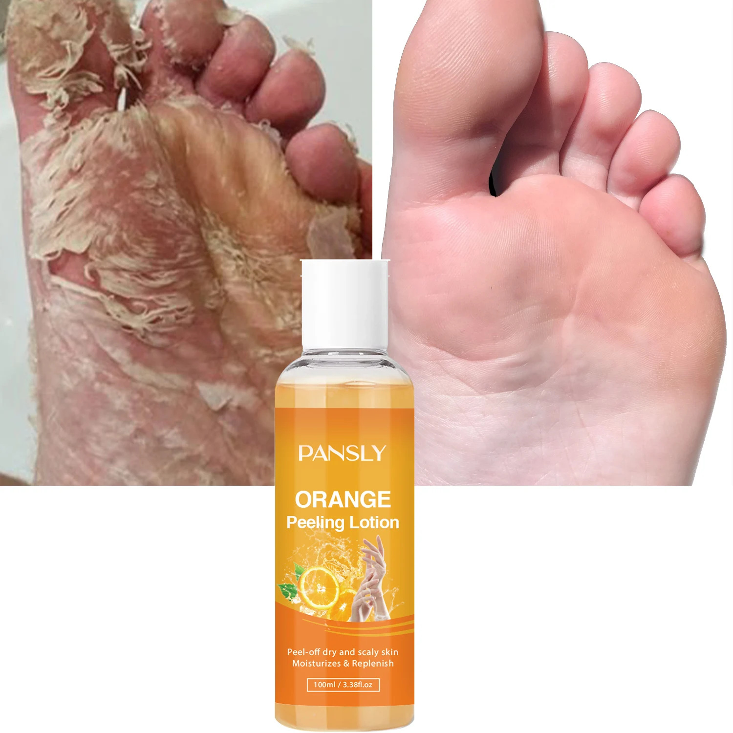 

Orange Peeling Lotion Remove Dead Skin Exfoliating Whitening and Smoothing New Skin Body Skincare Product 100ml