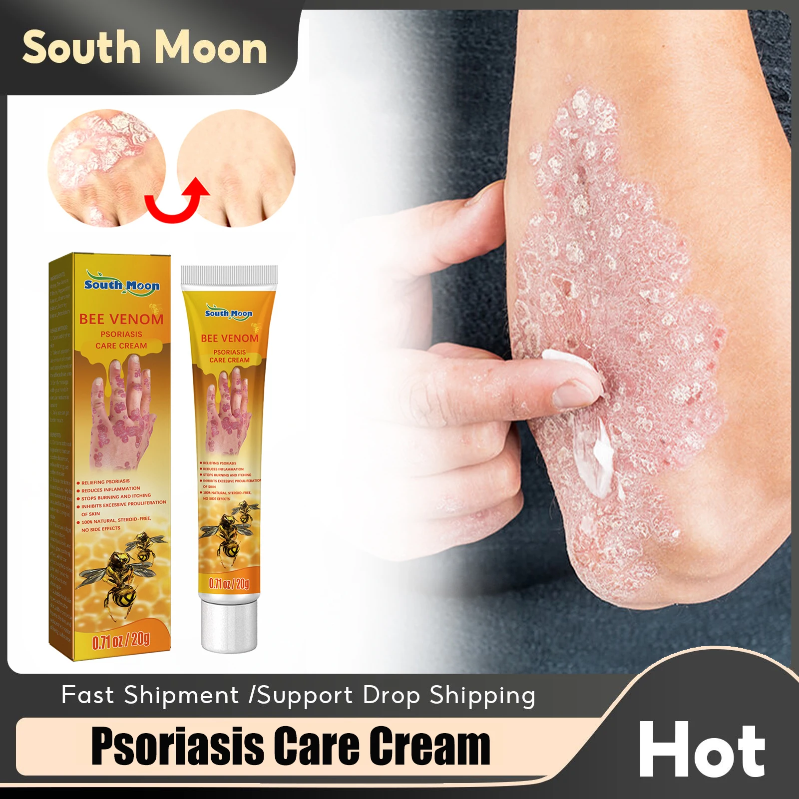 

Psoriasis Antibacterial Cream Anti Itch Treatment Hand Tinea Foot Eczema Rash Urticaria Desquamation Relieve Skin Cure Ointment