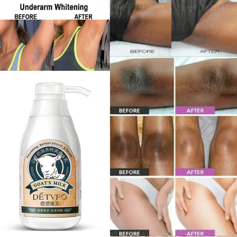 

300ml Instant Whitening Remove Melanin Body Lotion Goat Milk Body Lotion for Black Skin Brightening Lightening Nourishing