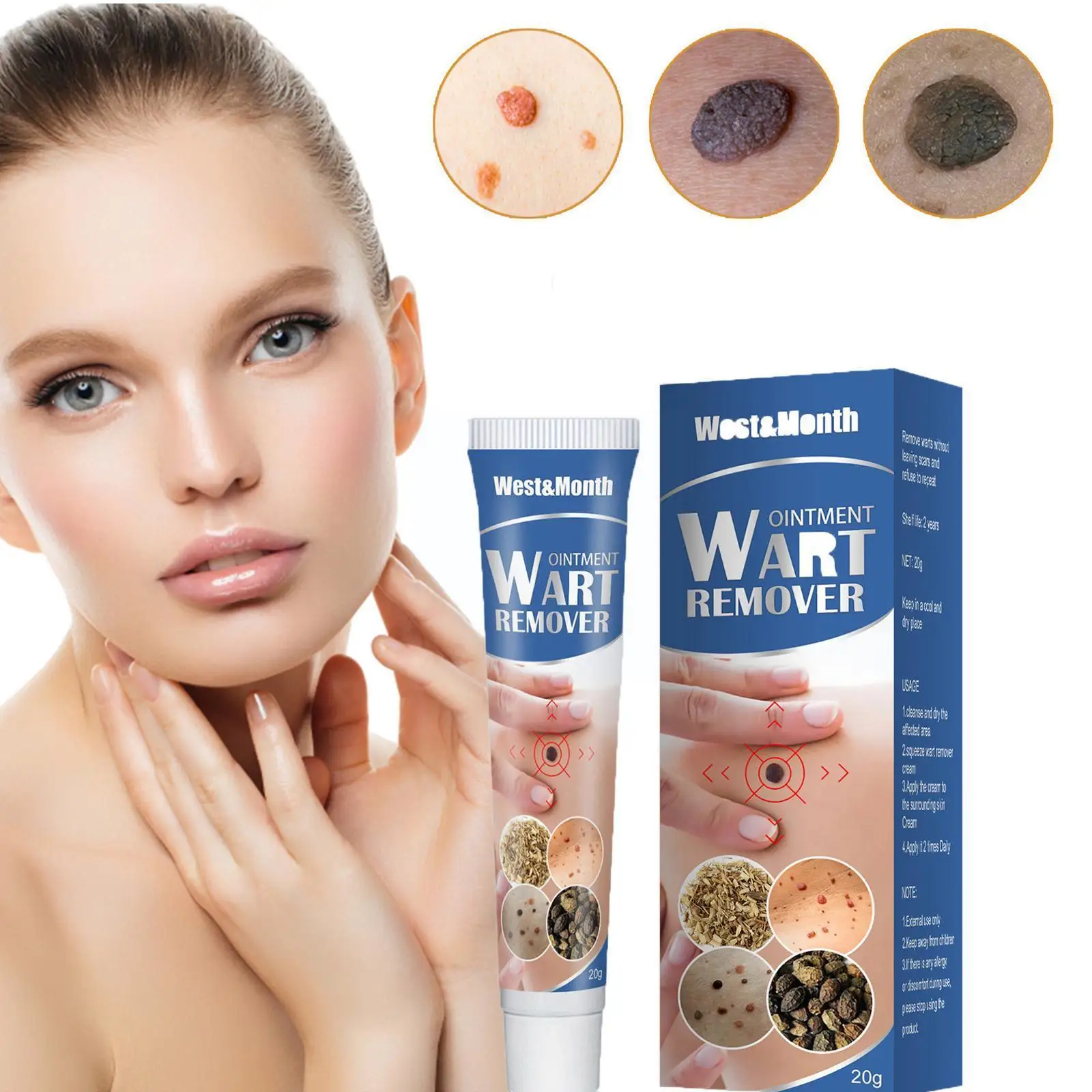 

Крем для лечения бородавок, 20 г, антибактериальное удаление бородавок, акне, травяная кожа, бирка на лапку, кукурузная мазь, медицинский плас...