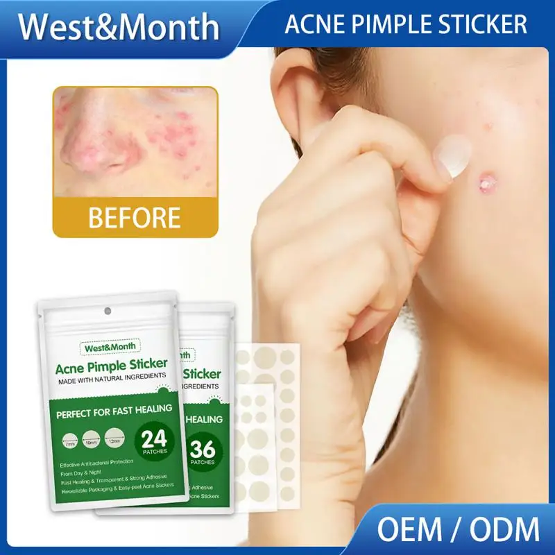 

24/36/144Pcs Waterproof Acne Pimple Patch Acne Pimple Remover Tool Invisible Breathable Acne Stickers Blemish Spot Facial Mask