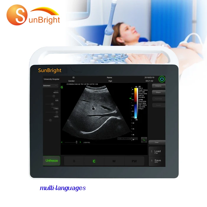 

Advanced ultrasound home care ultrasound machine cheapest medical ultrasound