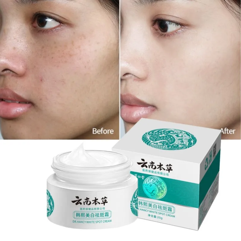 

Whitening Spot Cream Anti Aging Face Cream Freckles Cream Remove Melanin and Black Spots Moisturizing Beauty Creams Skin Care