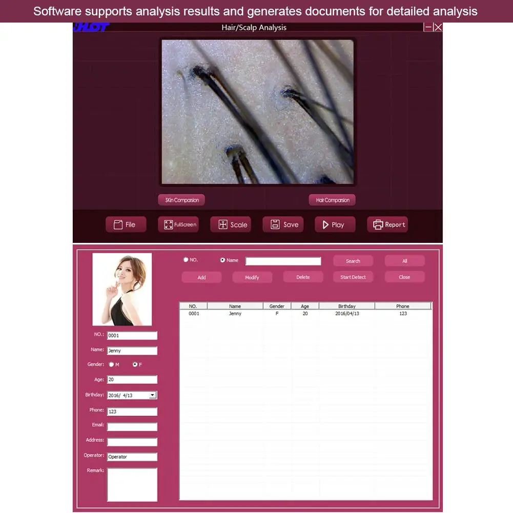 Фотоаппарат для ремонта волосяного фолликула-эндоскоп с увеличением 5-200 раз